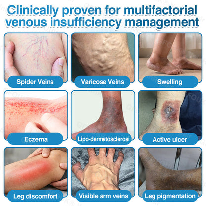🇨🇦👨‍⚕️✅GFOUK® VeinRepair Microneedle Patch Roll⚡Instant Relief, Long-Term Results